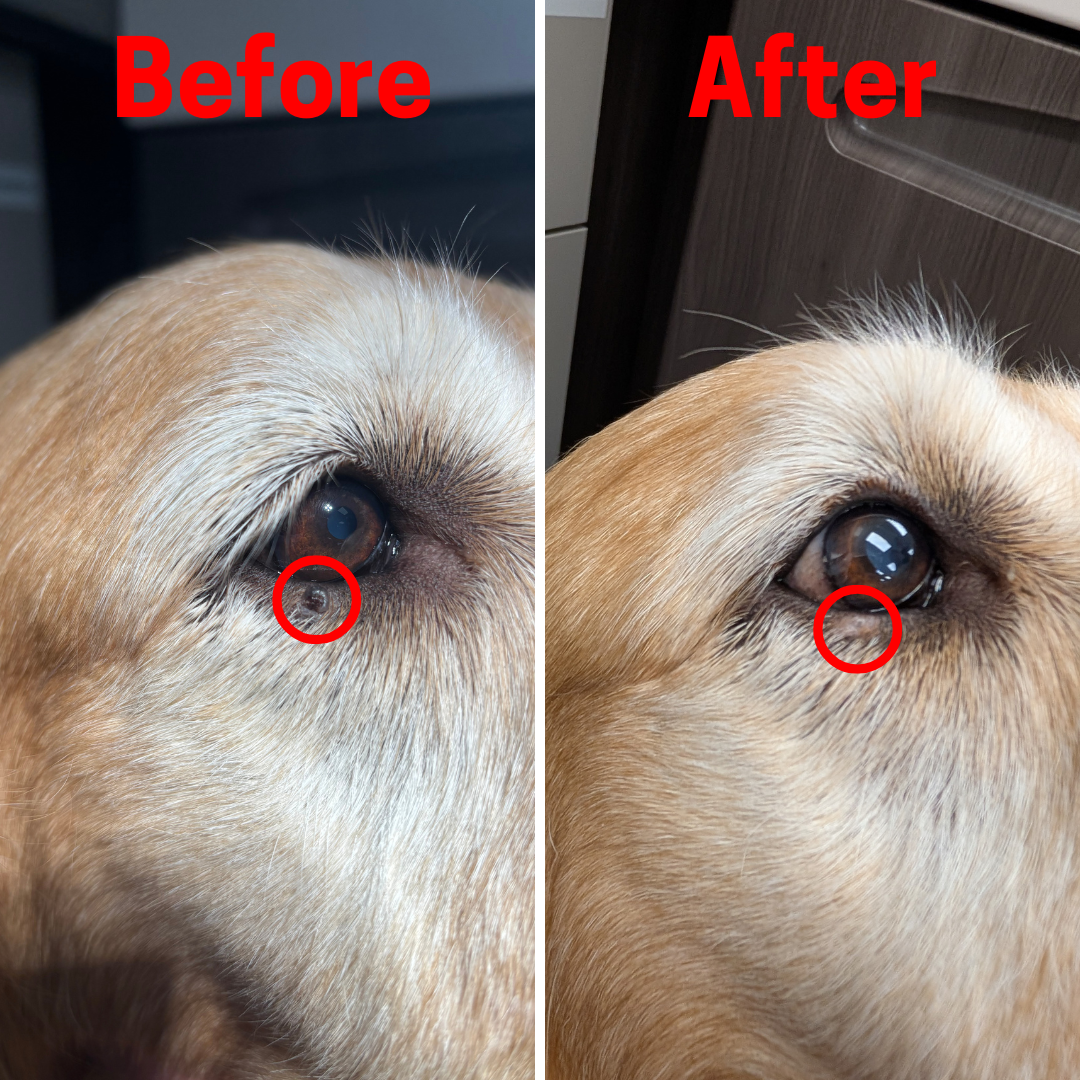 Cryotherapy before and after